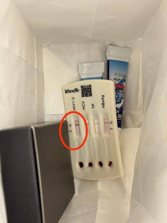 酒店洗漱包发现疑似HIV阳性检测盒 官方介入调查