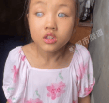 女孩2岁时基因突变双目失明 妈妈：产检时一切正常