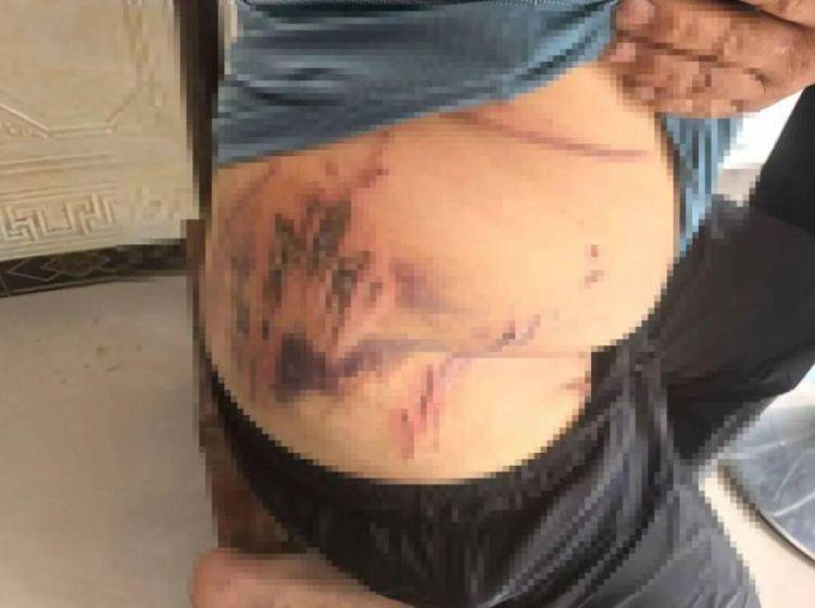 湖北鹤峰县疑再现老虎踪迹，村民家猪遭袭，玉米地发现脚印，此前男子自称干农活时被抓伤，当地回应